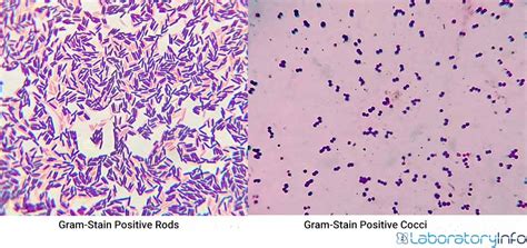 Gram Positive Bacteria Characteristics List Cell Wall Composition