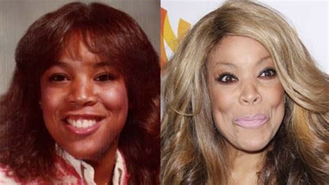 Wendy Williams Before And After Pictures