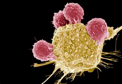 We did not find results for: Using engineered T-cells to treat cancer -- Science ...