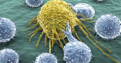 The 7 Differences Between Tumor And Cancer 2024