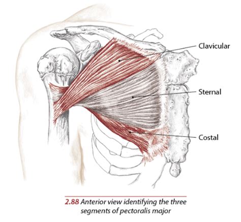 After a discussion with the patient about her treatment options, she elected for surgical repair of the pectoralis major tendon. Understanding and Training Pectoralis Major
