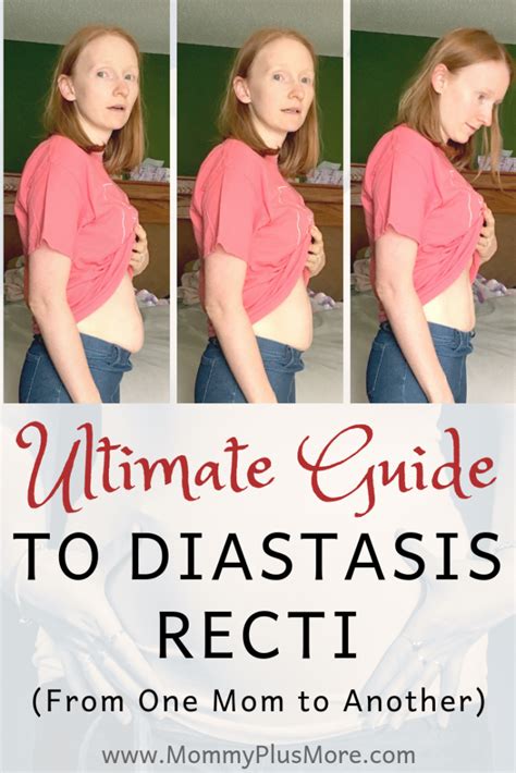 Ultimate Guide To Diastasis Recti Aka Mama Pooch Mommy Plus More