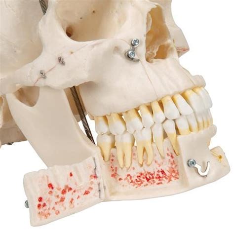 Deluxe Human Demonstration Dental Skull Model 10 Part 3b Smart Anatomy
