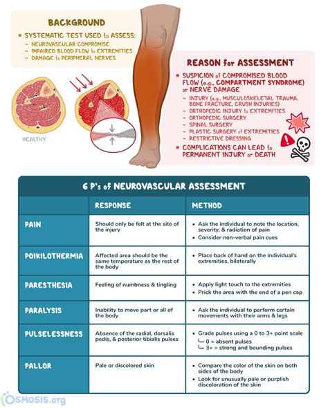 Neurovascular Assessment What Is It Why Its Performed And More