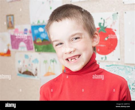 Smiling Boy Shows Lost Deciduous Teeth Stock Photo Alamy