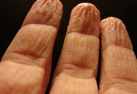 Wrinkled Fingers When Wet Make Objects Easier To Grasp Metro News