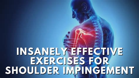 Insanely Effective Exercises For Shoulder Impingement Long Term Fix