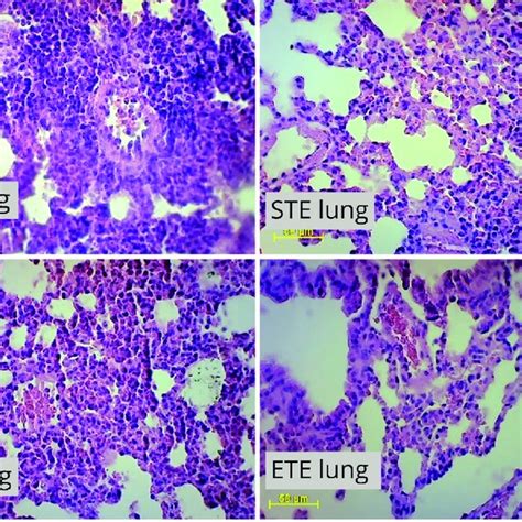 Stained Sections Of The Lung Histopathology Changes Of Lung In