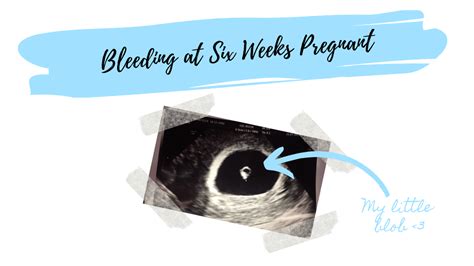 Cramping At 6 Weeks Pregnant Hiccups Pregnancy