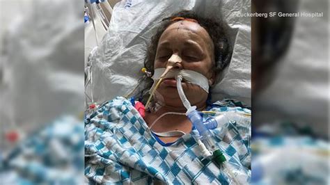 Officials With Zuckerberg San Francisco General Hospital Ask For Help Identifying Patient Found