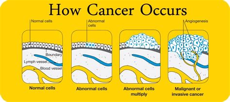 How Cancer Occurs And What Are The Types Of Cancer Cells