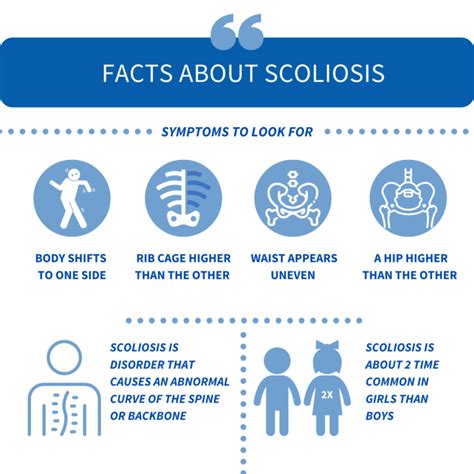 Scoliosis Causes Symptoms And Treatment Osteo Health Osteopath Clinic In Calgary