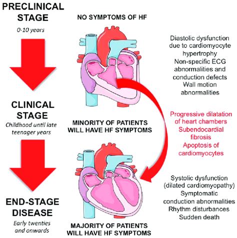 Natural Course Of Cardiovascular Impairment In Patients With Duchennes