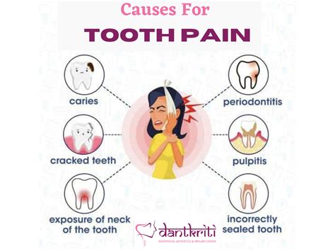 Treat Your Tooth Pain Without Pain Toothache Causes And Treatment In