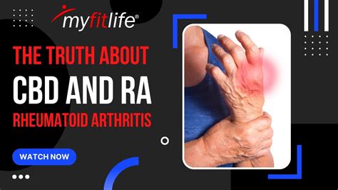 RHEUMATOID ARTHRITIS CBD CAN CBD HELP WITH RA YouTube