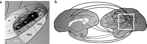 Figure 1 From Functional Organization Of Human Auditory Cortex During