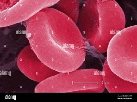 Scanning Electron Micrograph Of Red Blood Cells And Fibrin Stock Photo