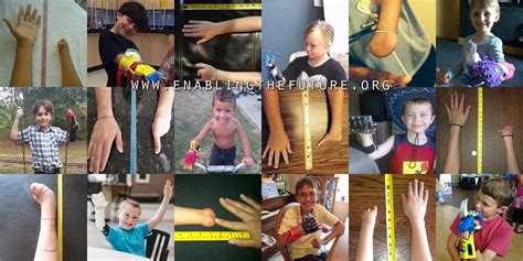 e nable 3d printed prosthetics why we do what we do enabling the future