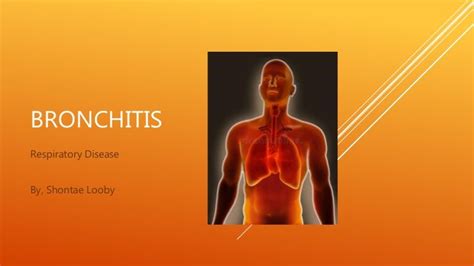 Bronchitis Powerpoint