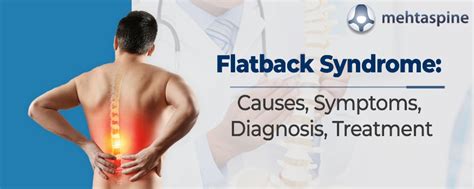 Flatback Syndrome Causes Symptoms Diagnosis And Treatment Mehta