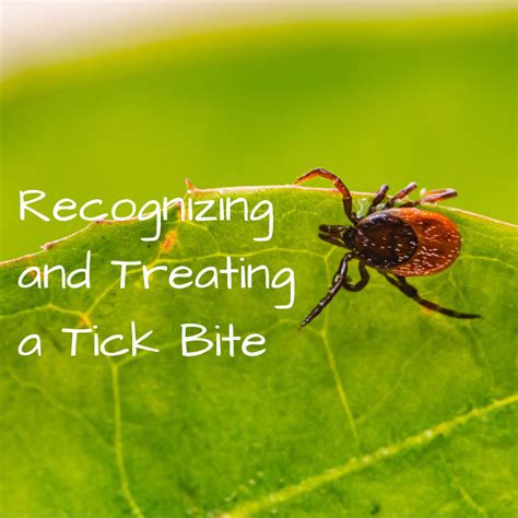 Tick Bite Pictures Symptoms Causes Treatment Youmemindbody