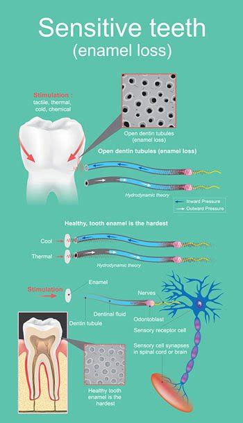 sensitive teeth sensitive teeth causes treatment tooth sensitivity
