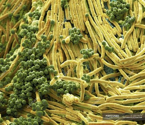 Coloured Scanning Electron Micrograph Of Bacteria Cultured From Mobile