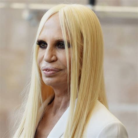 Donatella Versace Cosmetic Surgery After Pictures Botox Face Extreme