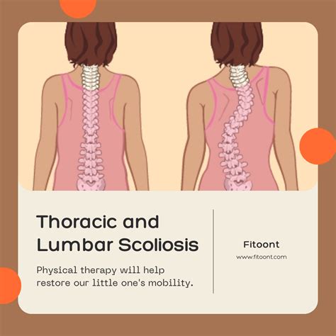 Thoracic And Lumbar Scoliosis The Real Symptoms And What To Do