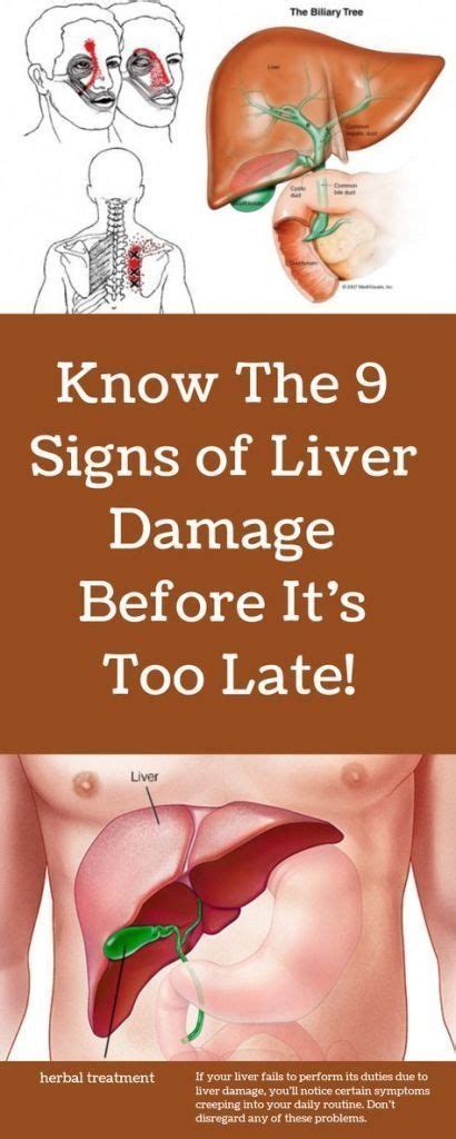 Know The 9 Signs Of Liver Damage Before Its Too Late Liver Issues