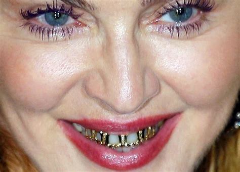 Weird Images Funny Images Braces Humor Madonna Looks Dentaltown