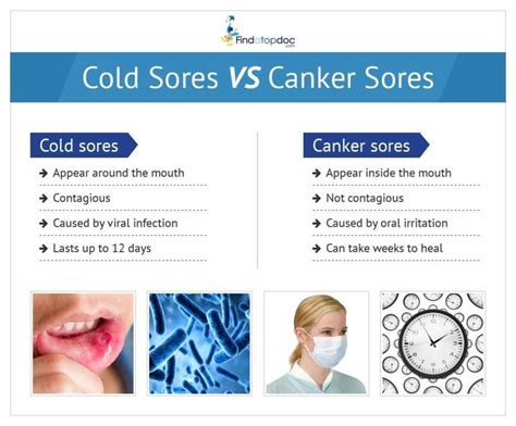 Cold Sore Symptoms Causes Treatment And Diagnosis Findatopdoc