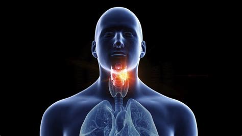 What Does Throat Cancer Look Like Images Throat Cancer High