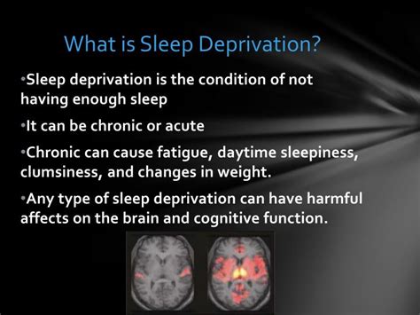 Ppt Sleep Deprivation In College Students Powerpoint Presentation