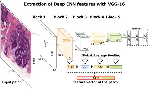 Deep Convolutional Neural Networks For Breast Cancer Histology Image Analysis Deepai