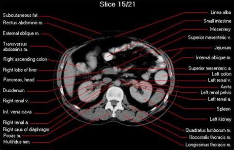 Abdominal Scan With Anatomical Labels Cross Section Normal