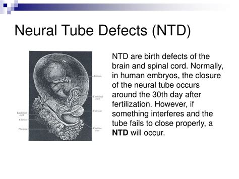 Ppt Folic Acid And Neural Tube Defects Powerpoint Presentation Free