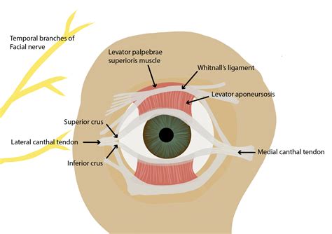 How To Perform A Lateral Canthotomy Eyeguru