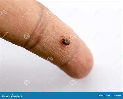 Ticks On Man Stock Photo Image Of Wood Tick White 55728126