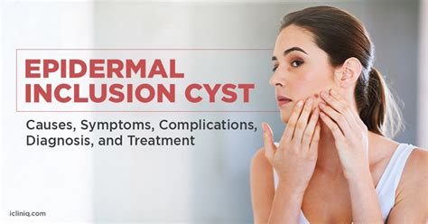 What Is Epidermal Inclusion Cyst