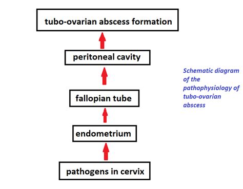 Solved Show In Schematic Diagram The Pathophysiology Of Tubo Ovarian