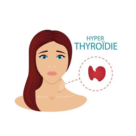 Hyperthyroïdie Symptômes Traitements Et Préventions Information Hospitalière Lexique Et