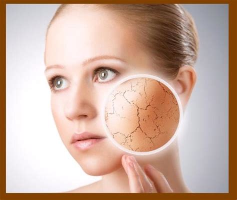 Causes Of Dry Skin Common Medical Questions