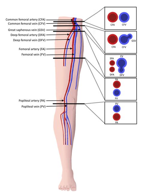 Cross Sectional Anatomy Of Lower Extremity Proximal Vasculature