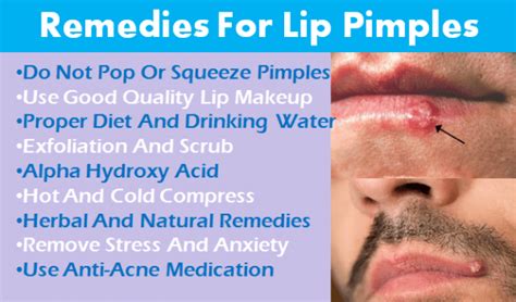 How To Get Rid Of Pimple On Lip Best Remedies For Bump On Lip