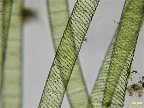 Spyrogyra A Genus Of Filamentous Green Algae You Can See The Spiral