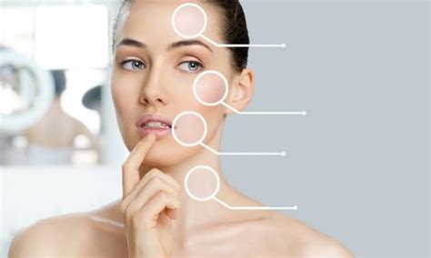 Skin Assessment Western Cape Janines Skin And Laser Clinic