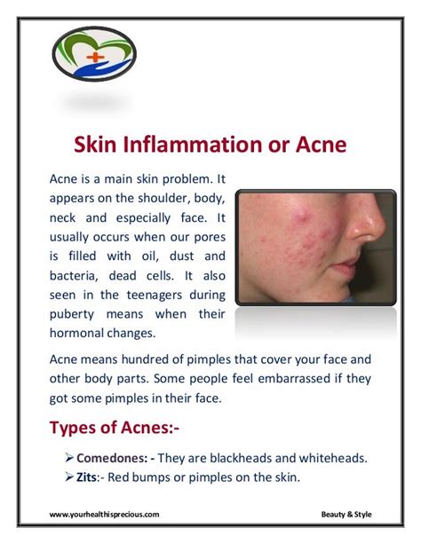 Skin Inflammation Or Acne