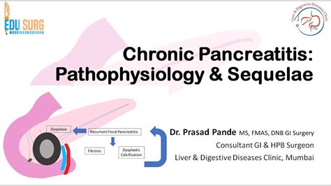 Chronic Pancreatitis Definition Causes Pathophysiology And Sequalae