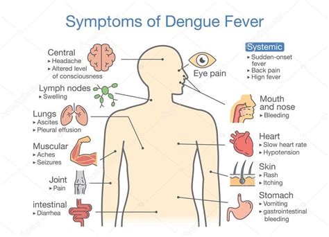 Pinpoint your symptoms and signs with medicinenet's symptom vomiting, along with nausea, is a symptom of an underlying disease rather than a specific illness itself. Sintomas Febre Dengue Paciente Ilustração Sobre Diagrama ...